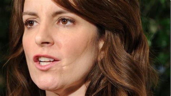 How Did Tina Fey Get Her Scar?